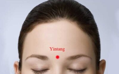 El Punto Yin Tang para la migraña