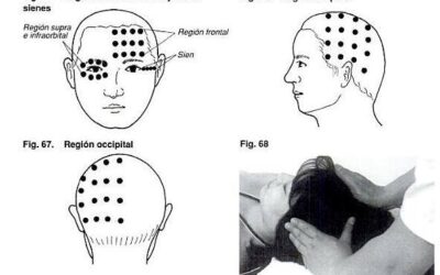 SIATHSU PARA LA MIGRAÑA