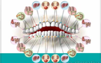 Descodificación Dental