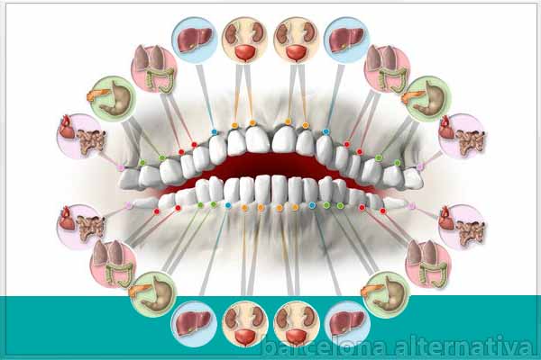 Descodificación Dental