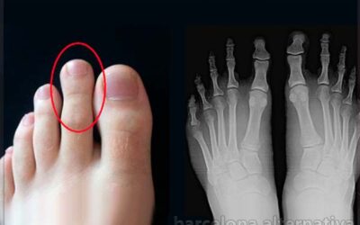 ¿Tienes el segundo dedo más largo que el pulgar?