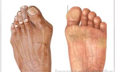 CONFLICTOS EMOCIONALES EN LOS PIES